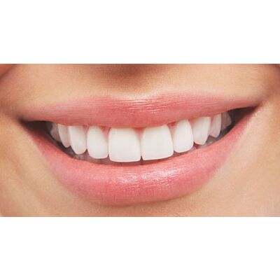 Soglio - Alpine 'Fluoride-Free Toothpaste' (75 ML)